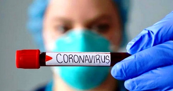 За минулу добу на Черкащині виявили 266 хворих на коронавірус